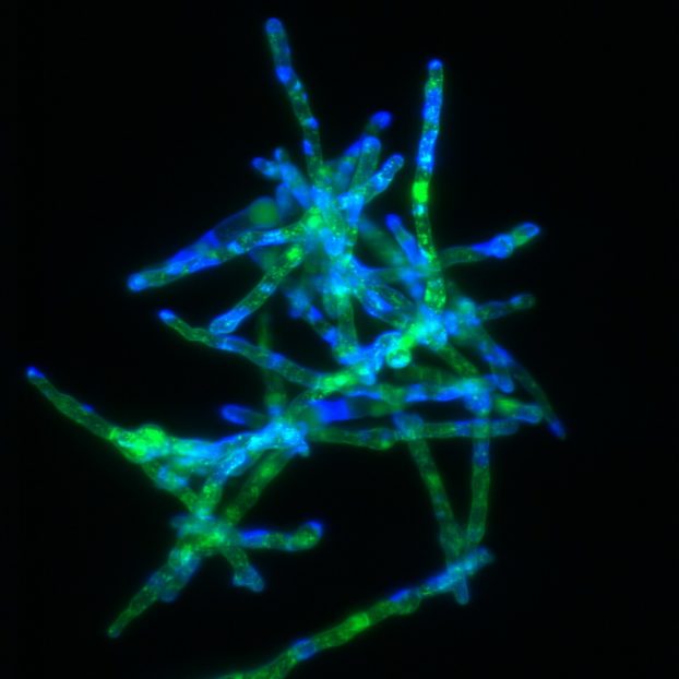 Aspergillus fumigatus