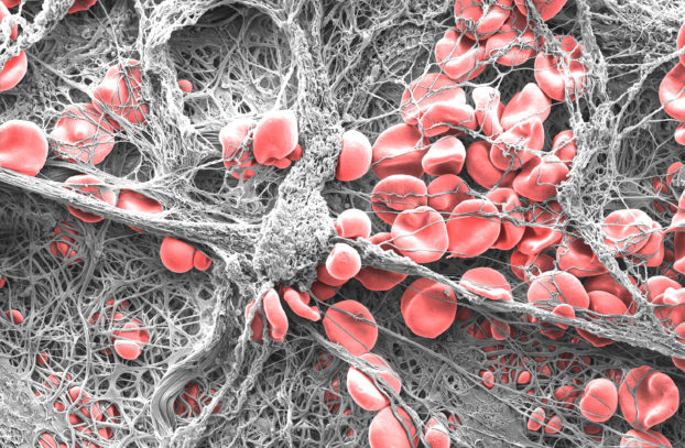 “Clotted” by Dr Eli Moore - 1st prize winner of UniSA’s Images of Research Photography Competition