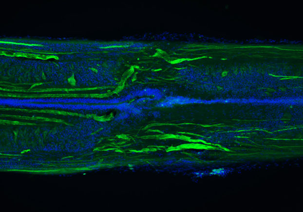 Lamprey spinal cord 