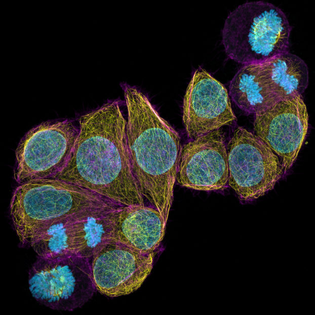 HeLa cells imaged with ZEISS Airyscan 2