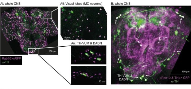 Variations in Rab expression contribute to differences in neurodegeneration seen in Parkinson’s