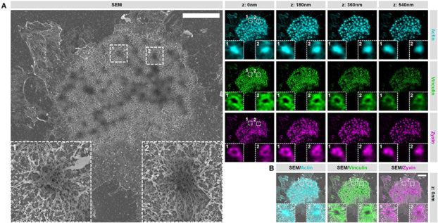 VPM preparation and CPD procedure preserve podosome organization