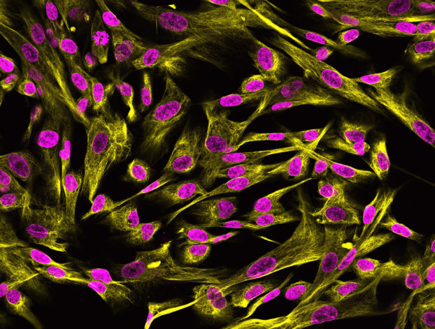 Human umbilical cord mesenchymal stromal cells in culture