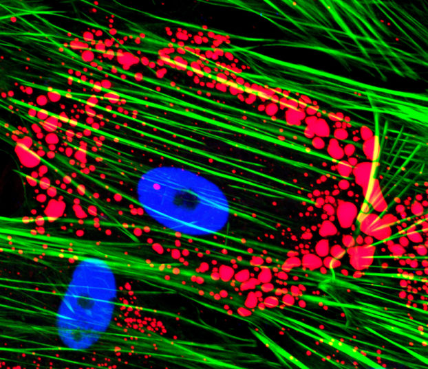 Human umbilical cord mesenchymal stromal cells after they were induced for adipogenic transdifferentiation in vitro for 35 days