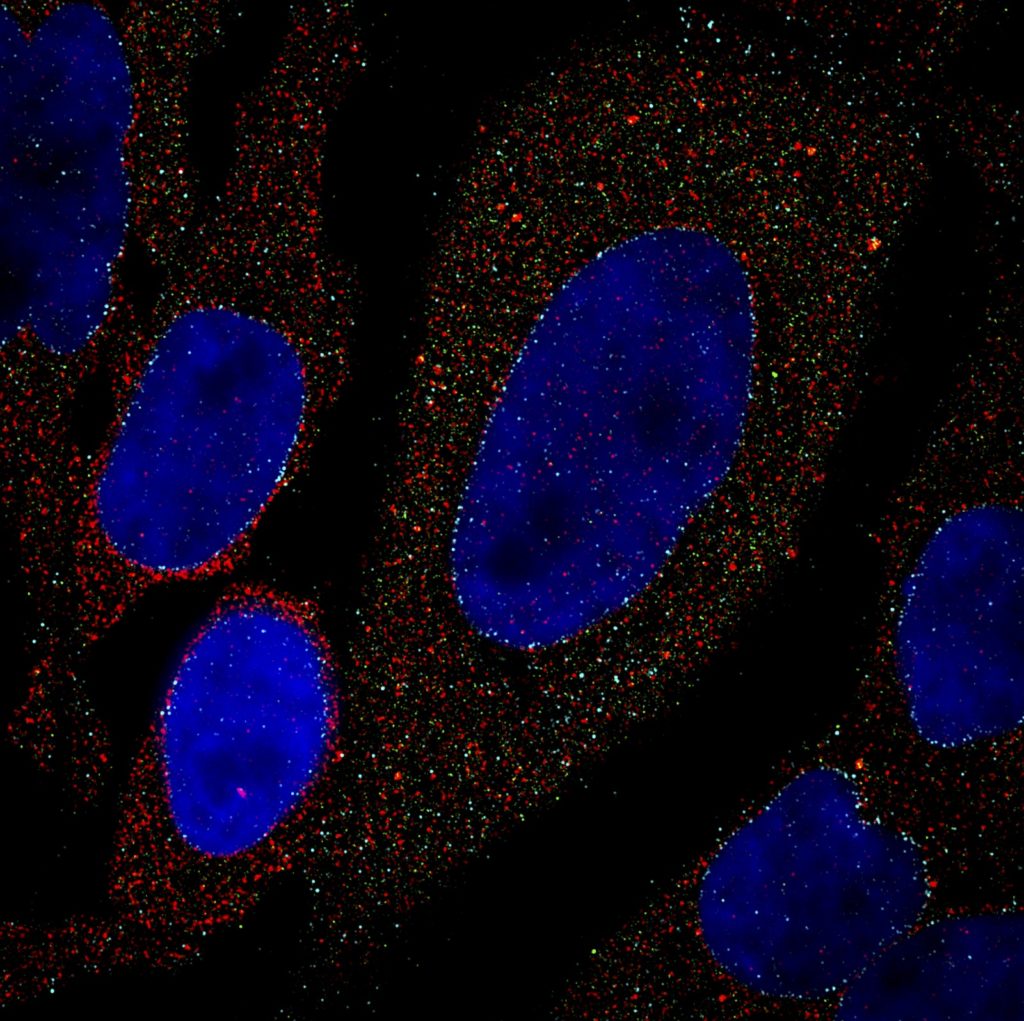 Superresolution HeLa Cells