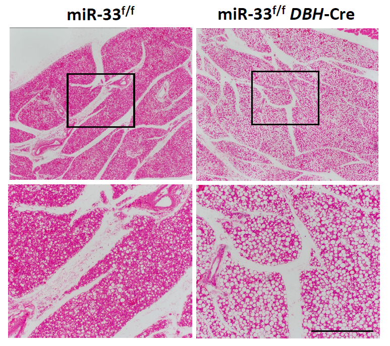 Representative images of HE staining for the BAT of miR-33f/f and miR-33f/f DBH-Cre mice kept at 4 °C for 5 h. Scale bar, 200 microns. Image courtesy of Dr. Koh Ono and Dr. Takahiro Horie, Kyoto University (Japan)