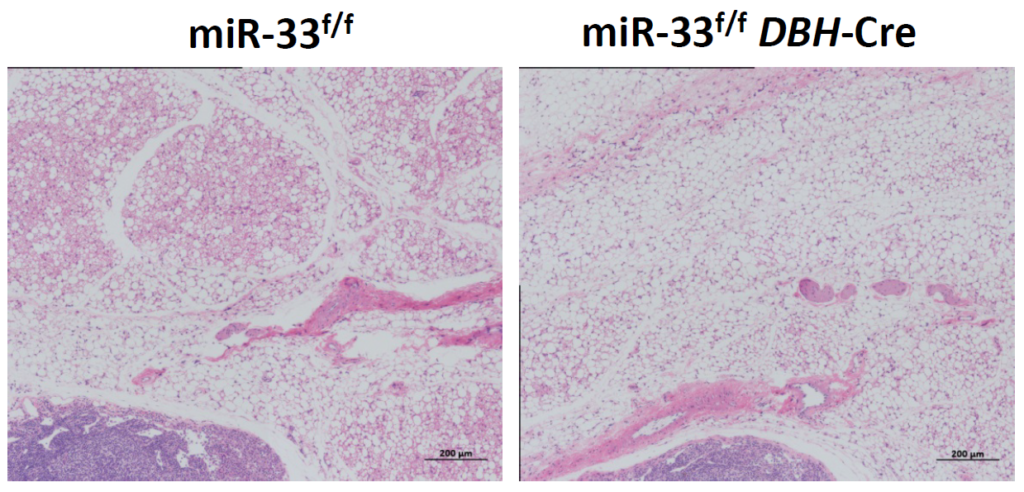 Representative images of HE staining for inguinal WAT kept at 16°C for 1 week in miR-33f/f and miR-33f/fDBH-Cre mice. Scalebar: 200μm. Image courtesy of Dr. Koh Ono and Dr. Takahiro Horie, Kyoto University, Japan