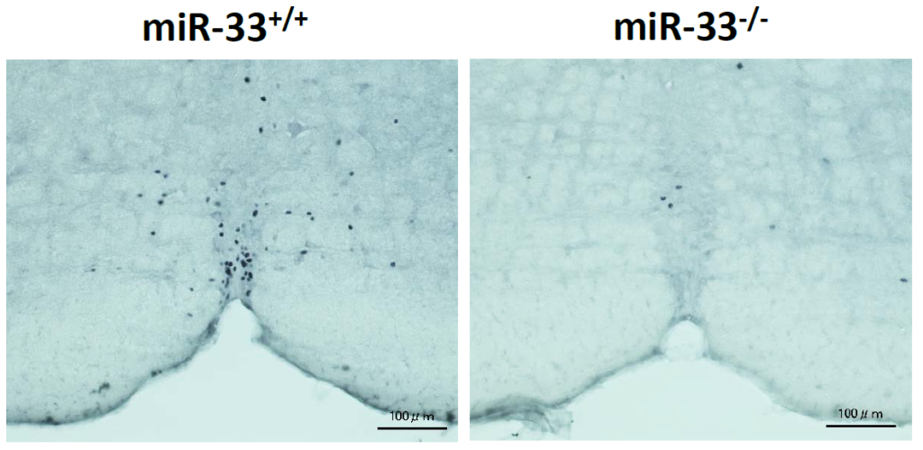 Representative images of c-fos immunohistochemistry in the rRPa of miR-33+/+ and miR-33−/− mice kept at 4°C for 2h. Scalebar:100μm. Image courtesy of Dr. Koh Ono and Dr. Takahiro Horie, Kyoto University (Japan)