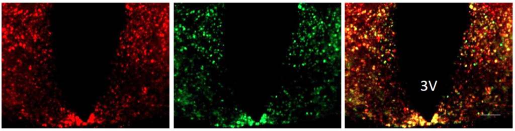 Representative fluorescent images of the region around the 3rd ventricle of miR-33f/fDBH-Cre mice brains infected with AAV9 vector. Scalebar: 100μm. Image courtesy of Dr. Koh Ono and Dr. Takahiro Horie, Kyoto University (Japan)