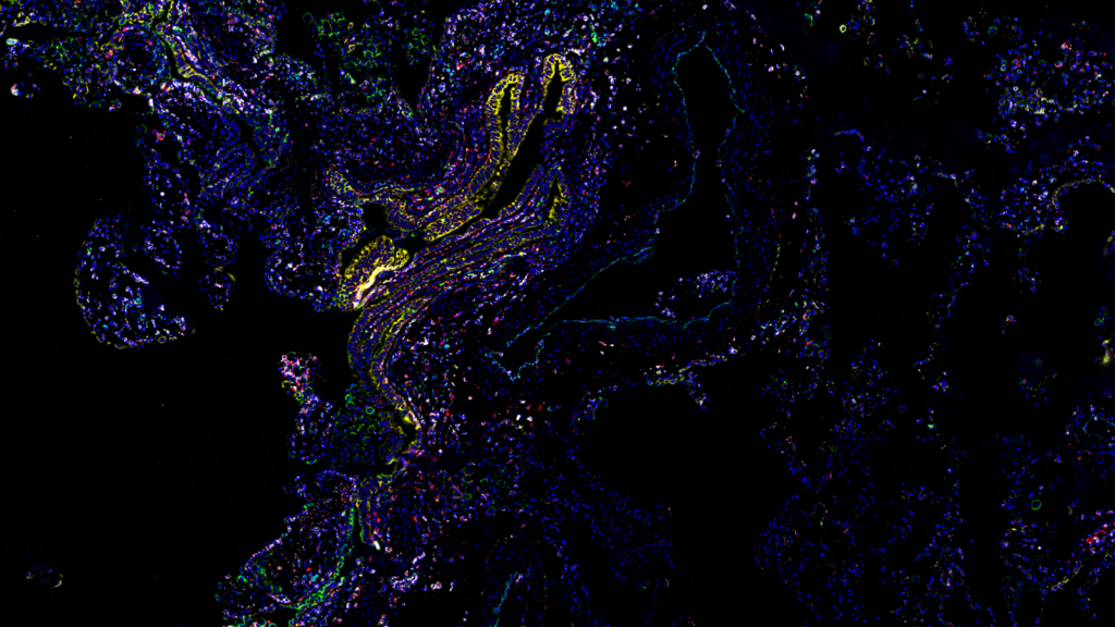 Human-Lung-Imaged-With-37-antibody-codex-panel-inset