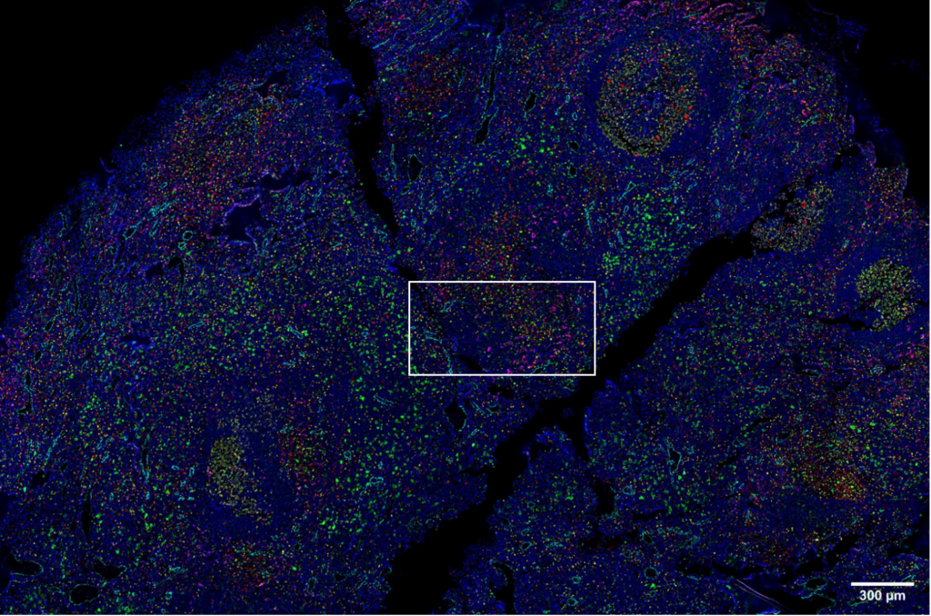 Human-lymph-node-imaged-with-14-antibody-codex-panel