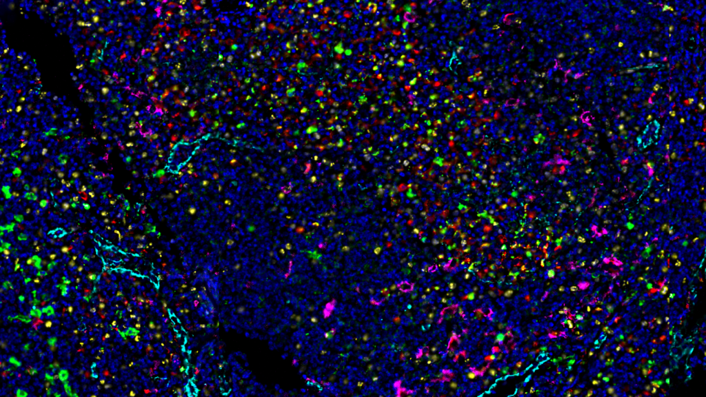 Human-lymph-node-imaged-with-14-antibody-codex-panel-inset