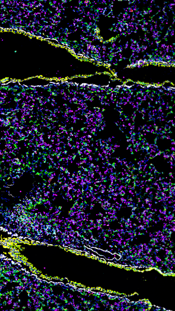 Mouse-Lung-Imaged-With-37-antibody-codex-panel-inset