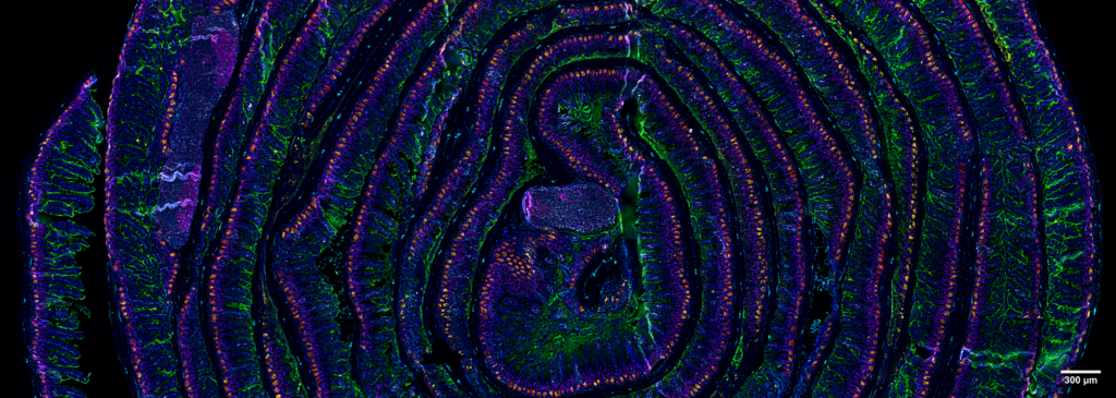 5 µm section of a formalin fixed paraffin-embedded mouse small intestine swiss roll. Section was stained with a 14 CODEX antibody panel designed to visualize intestinal stem and enteroendocrine cells (Lysozyme in red, villin in green, MHCII in gray, vimentin in cyan, Ki67 in magenta, and Olfm4 in yellow). Blue signals correspond to DAPI nuclear staining. Acquisition was done with a ZEISS Axio Observer microscope and processing with the Akoya CODEX Processor. Image courtesy of Prof. Andreas Schlitzer at the Life and Medical Sciences Institute (LIMES) of the University of Bonn (Germany).