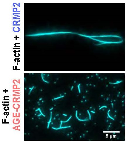 Actin bundling assay for CRMP2 or AGE-CRMP2 using TIRF microscopy. Note that CRMP2 (Upper) but not hypercarbonylated AGE-CRMP2 (Lower) could facilitate actin bundling. Scale bar, 5 μm.