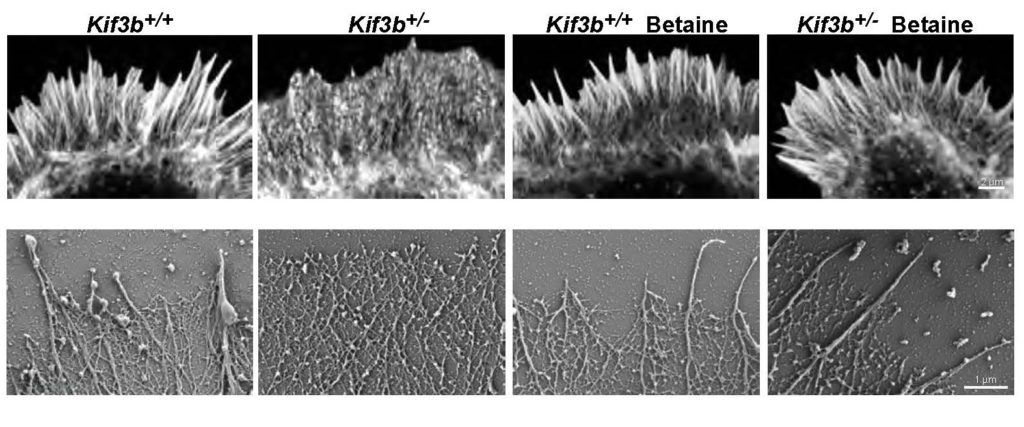 Imaging of actin cytoskeleton in the lamellipodia of primary hippocampal neurons of the indicated conditions at DIV1 either by Airyscan superresolution microscopy labelled with fluorescent phalloidin (top), or by scanning electron microscopy (bottom). Scale bars, 2 μm (top) and 1 μm (bottom).