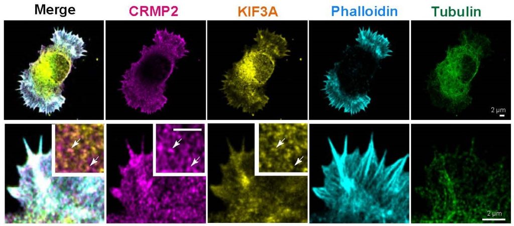 Immunofluorescence micrographs of a Kif3b+/+ primary hippocampal neuron at DIV1 labeled with an antibody against CRMP2 (Magenta), an antibody against KIF3A (Yellow), fluorescent phalloidin (Cyan), and an antibody against α-tubulin (Green), at low (Upper) and high magnifications (Lower), imaged using confocal microscopy.