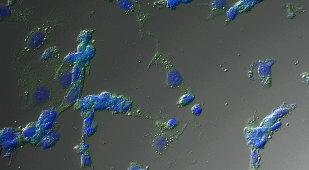 Cervical cancer cells showing RBBP6 expression (green) and nuclear marker DAPI. Image courtesy of Dr. Pontsho Moela, University of Pretoria (South Africa)