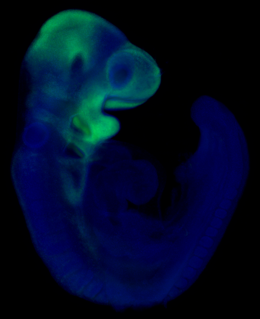 Neural crest cells mouse embryo