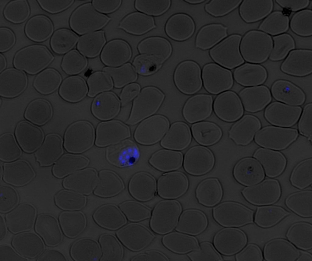 Plasmodium falciparum parasites