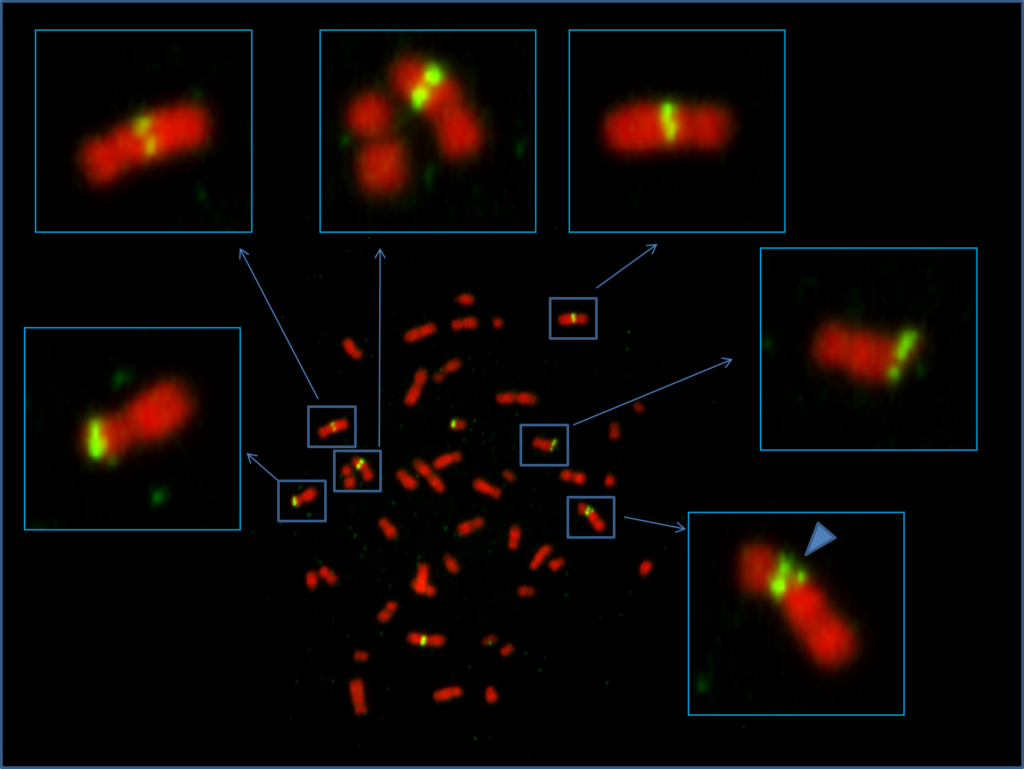 Metaphase Spread