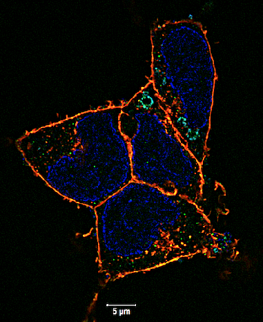 Human-embryonic-kidney-HEK-ACE-cells_HuluFISH_SARS-CoV-2_Drug-Treated_Elyra7_superresolution