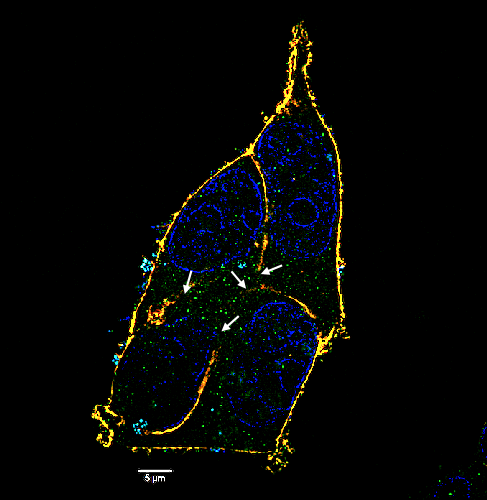 Human-embryonic-kidney-HEK-ACE-cells_HuluFISH_SARS-CoV-2_Elyra7_superresolution.png