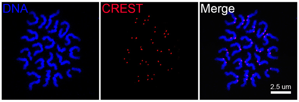 Chromosome spreading was performed to assess the euploidy of mouse oocyte at metaphase II stage. Matured oocyte was immunostained with CREST to display the kinetochores and counterstained with Hoechst to show the chromosomes. Image acquired with ZEISS LSM 900. Courtesy of B. Xiong, College of Animal Science and Technology, Nanjing Agricultural University, China.