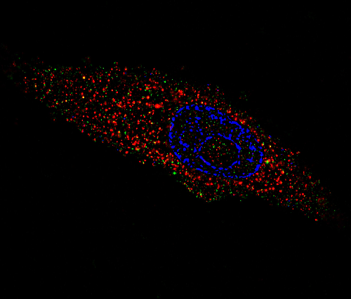 Immunofluorescence (IF) staining with antibodies against ACE2 protein (red) and viral nucleoprotein (green). Vero E6 cells were infected with SARS-CoV-2 D particles 0.2 MOI/ cell for 72 hours. The SIM image was acquired with Elyra 7 and processed with Zeiss ZEN software (blue edition). Courtesy M. Zollo, CIENGE, Italy