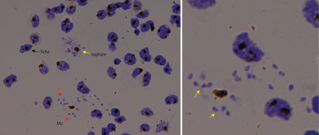 Giemsa stain of malaria parasites rupturing and invading red blood cells. Schz: Schizont - young malaria parasite. Yellow arrow - ruptured cells. Red arrows - liberated daughter parasites, merozoites (Mz). Image acquired with ZEISS Axioscan. Courtesy: S. Froelich, Malaria Biology (Wilson) Laboratory, Research Centre of Infectious Diseases, the University of Adelaide, Australia