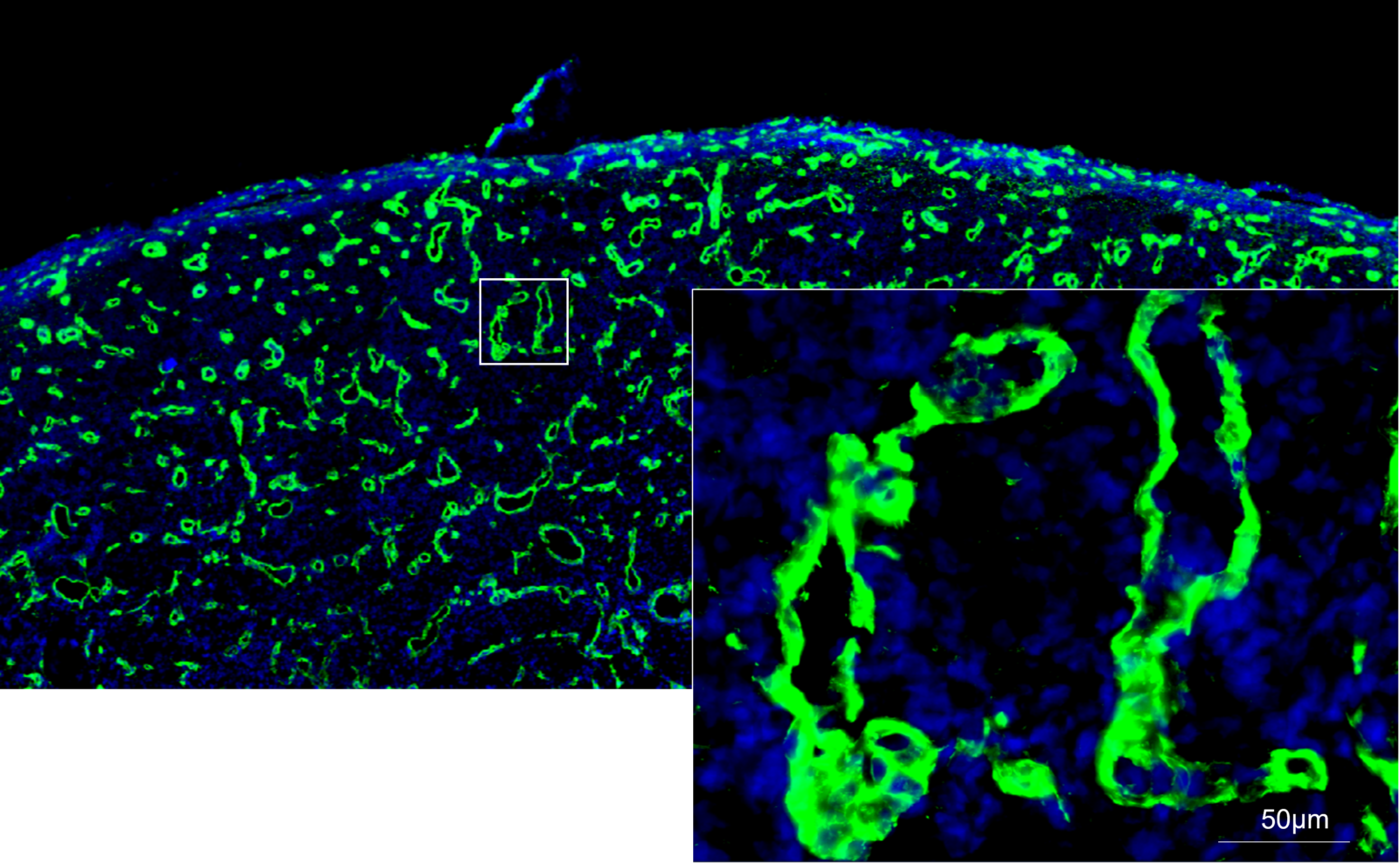 Image 3: Collagen 1 and Nuclei