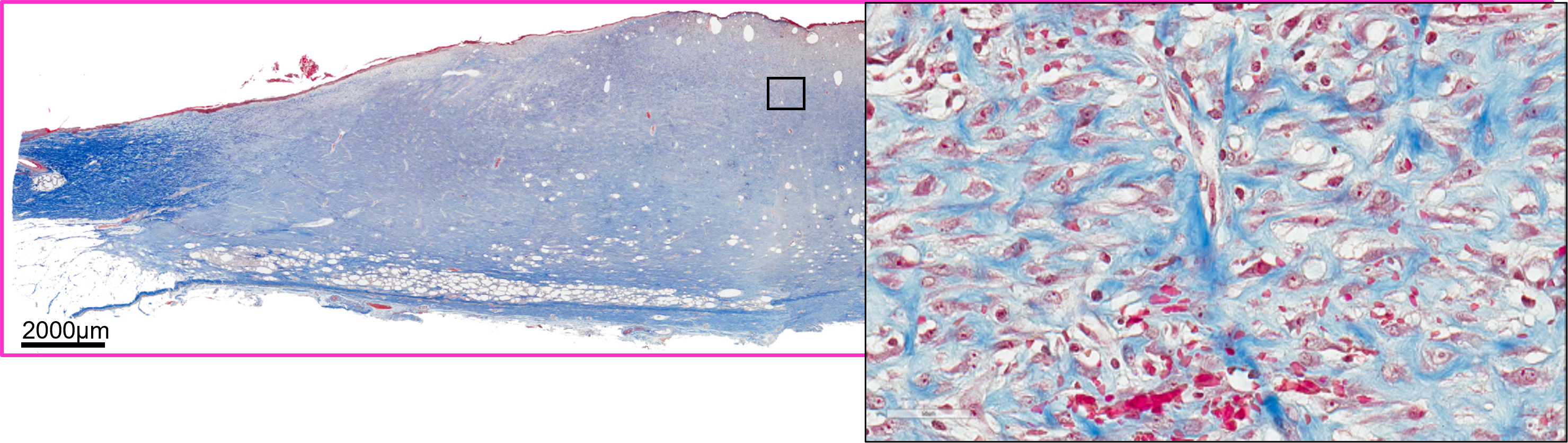 Image 2: Masson's trichrome stain