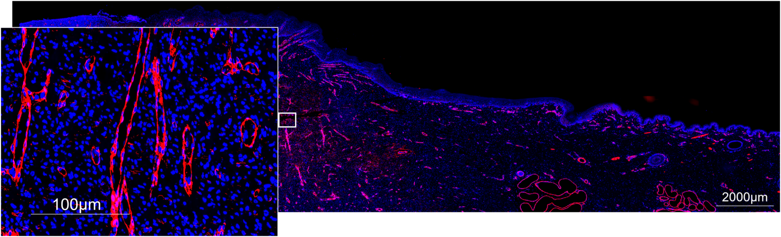 Image 4: Smooth Muscle Actin and Nuclei