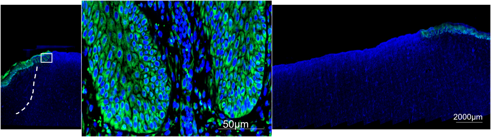 Image 5: Tight junction proteins and nuclei