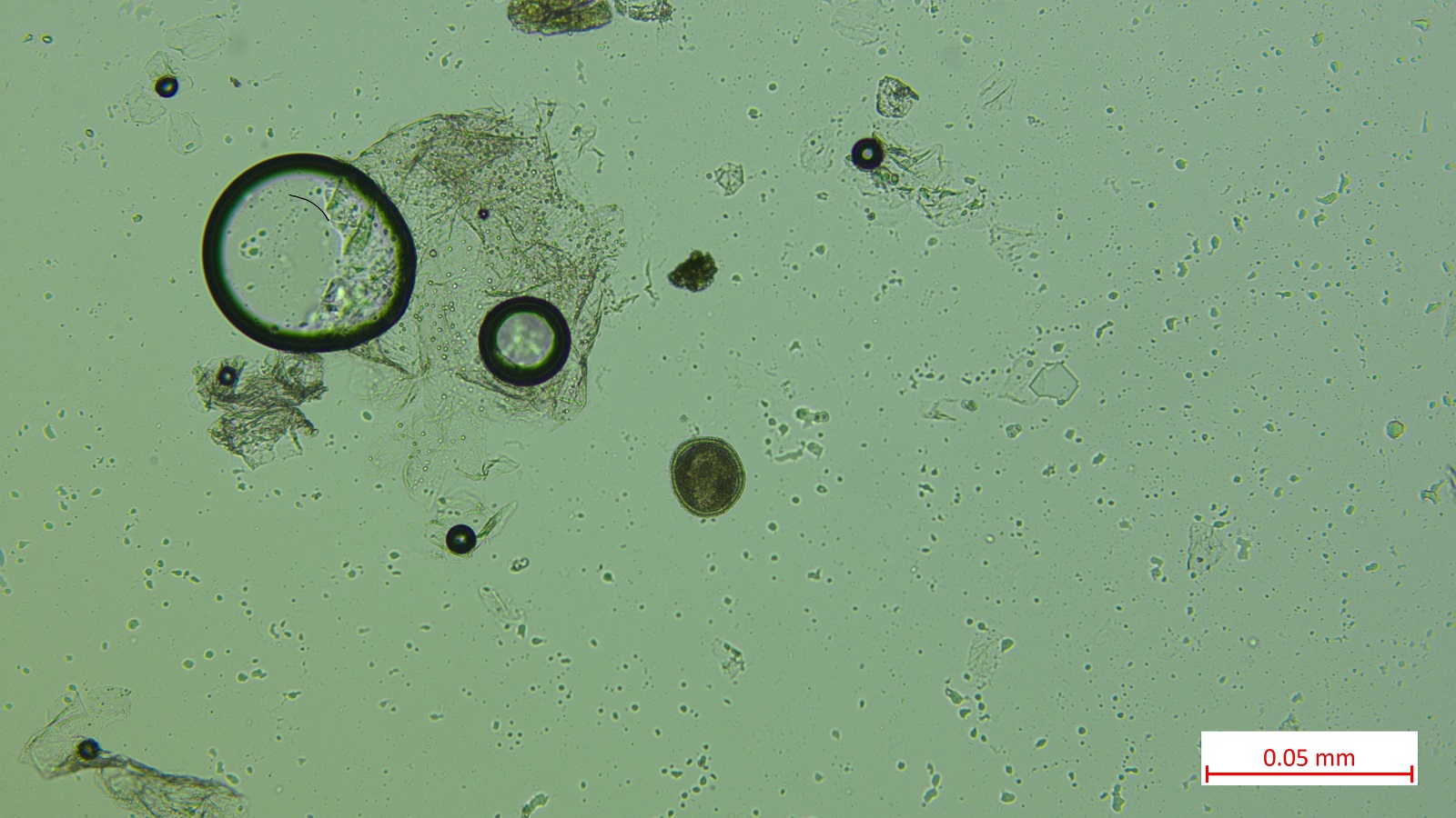 Roundworm egg