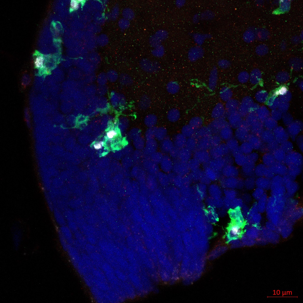 zebrafish-amoeboid-microglia-enriched-in-the-optic-tectum